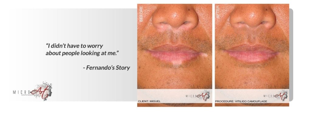 Fernando’s before and after