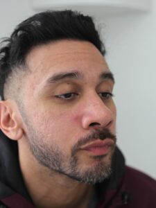 AFTER3RDSESSION-SCARONFACE-MAN