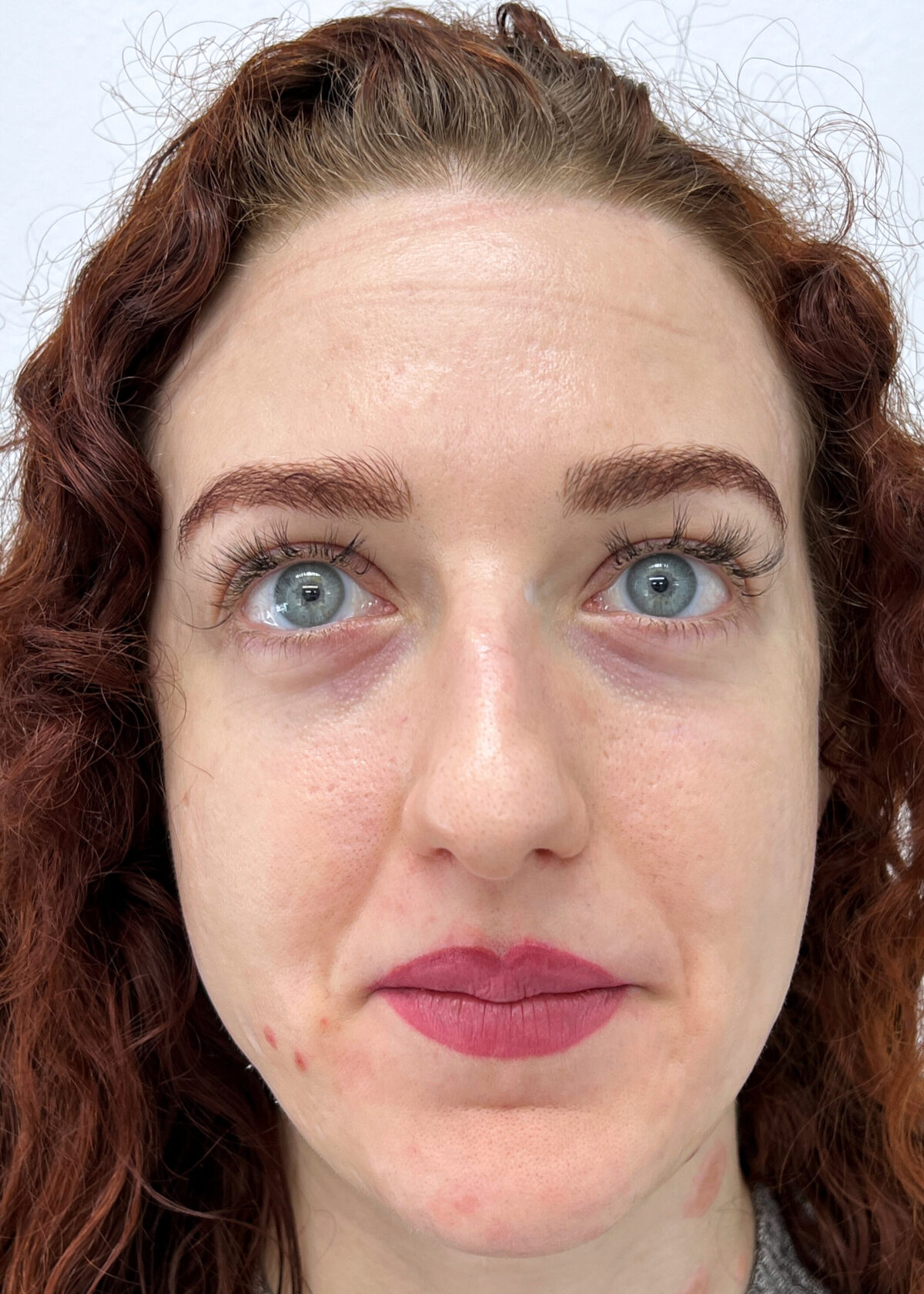 Permanent Makeup Removal by MicroArt Semi Permanent Makeup