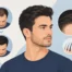 Guide to Non Surgical Hairlines That Look Real