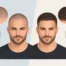 Scalp Shading vs Hair Fibers: Which Looks Better?
