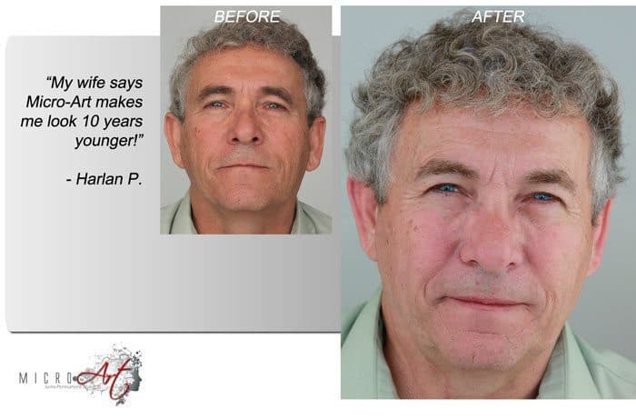 Before & After Photos of MicroArt Semi Permanent Makeup for Men