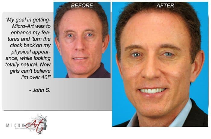 Before & After Photos of MicroArt Semi Permanent Makeup for Men