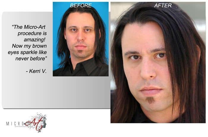 Before & After Photos of MicroArt Semi Permanent Makeup for Men