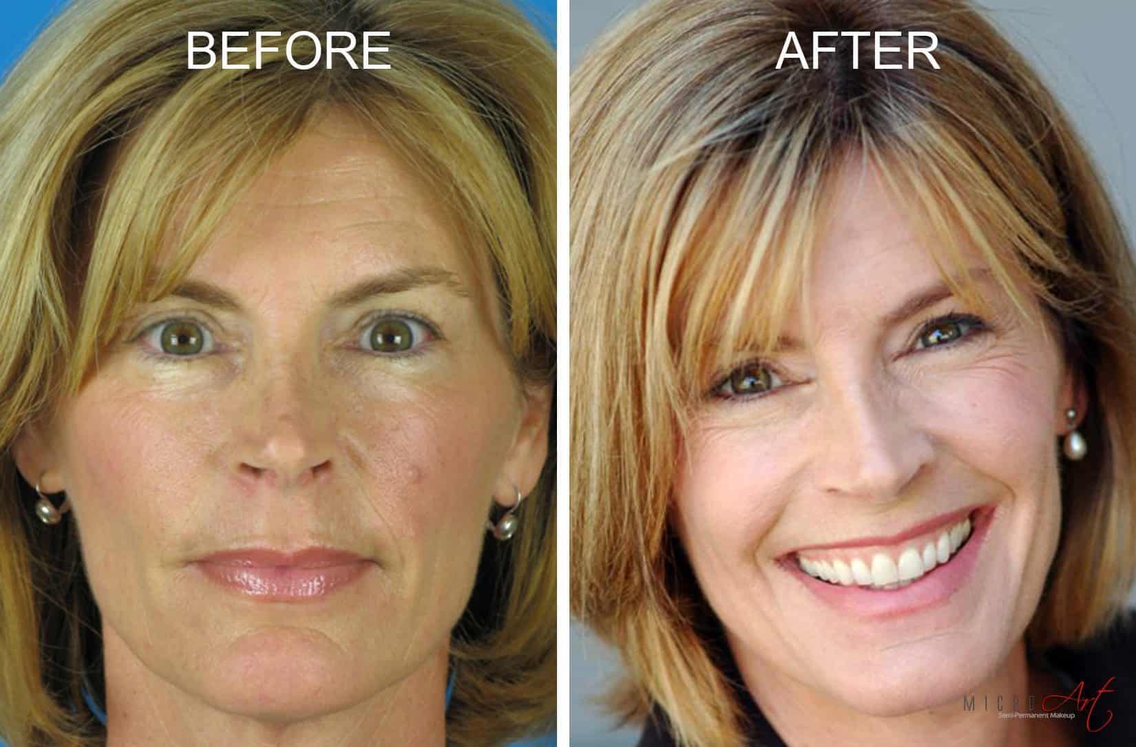 Before and After Photos of MicroArt Semi Permanent Makeup – an Alternative to Eyebrow Tattooing and Permanent Cosmetics-LindaK Before & After Photos of MicroArt Semi Permanent Makeup for Eyebrows, Eyeliner & Lips - an Alternative to Eyebrow Tattooing and Permanent Cosmetics