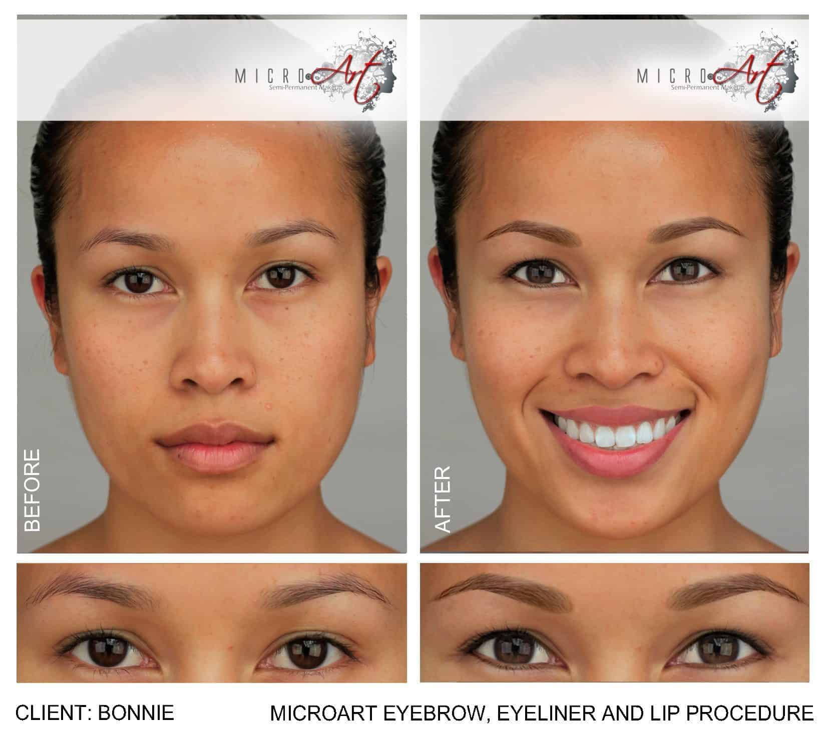 Before and After Photos of MicroArt Semi Permanent Makeup – an Alternative to Eyebrow Tattooing and Permanent Cosmetics -Bonnie Before & After Photos of MicroArt Semi Permanent Makeup for Eyebrows, Eyeliner & Lips - an Alternative to Eyebrow Tattooing and Permanent Cosmetics