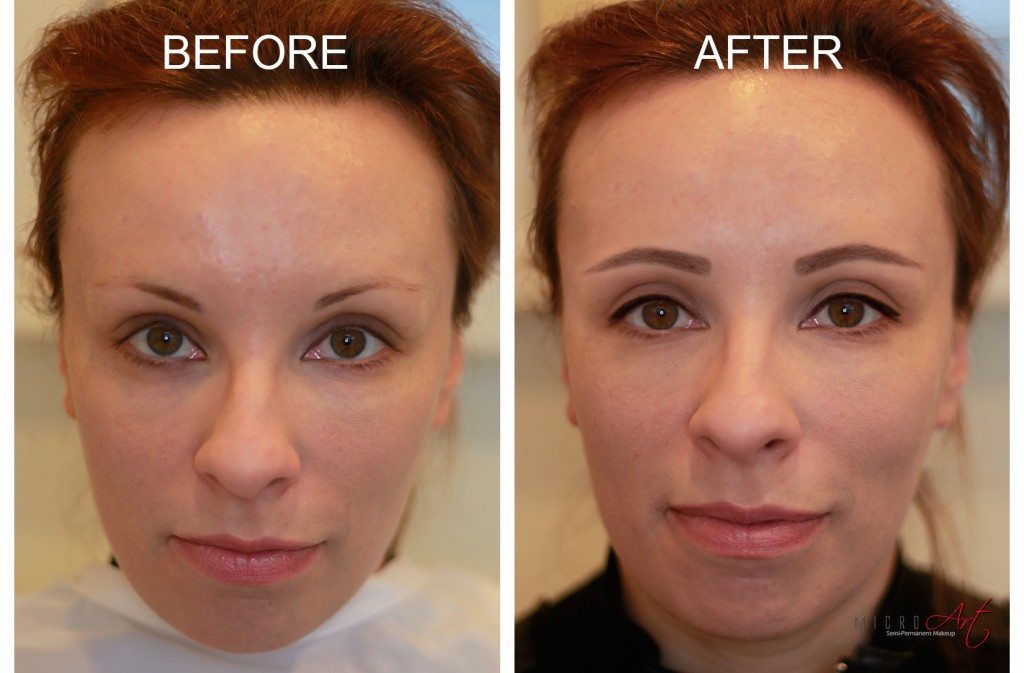 Before and After Photos of MicroArt Permanent Makeup Correction and Eyebrow Reconstruction
