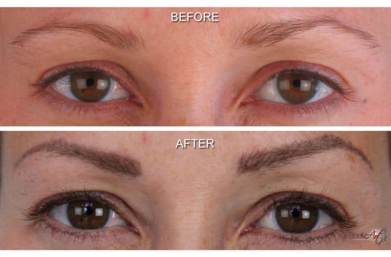 Permanent Makeup eyebrows before and after photos by MicroArt