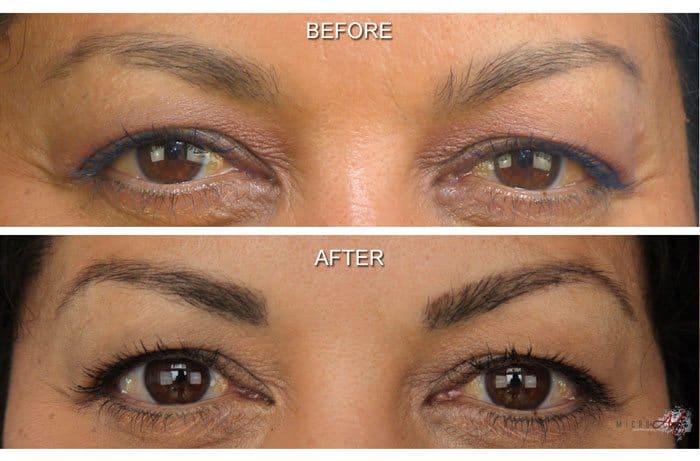 Before & After Photos of MicroArt Semi Permanent Makeup for Eyebrows & Eyeliner - Before & After Photos of MicroArt Semi Permanent Makeup for Eyebrows & Eyeliner - Semi Permanent Makeup Training