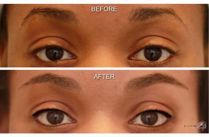 Before & After Photos of MicroArt Semi Permanent Makeup for Eyebrows & Eyeliner - an Alternative to Eyebrow Tattooing and Permanent Cosmetics