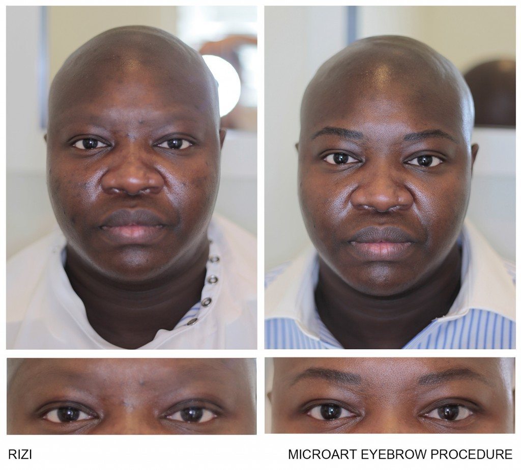 Before & After Photos of MicroArt Semi Permanent Makeup for Men