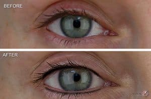 Before & After Photos of MicroArt Semi Permanent Makeup for Eyeliner - an Alternative to Tattooing and Permanent Cosmetics