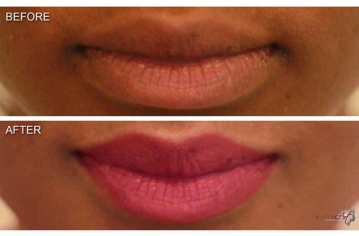 MicroArt Semi Permanent Makeup on lips