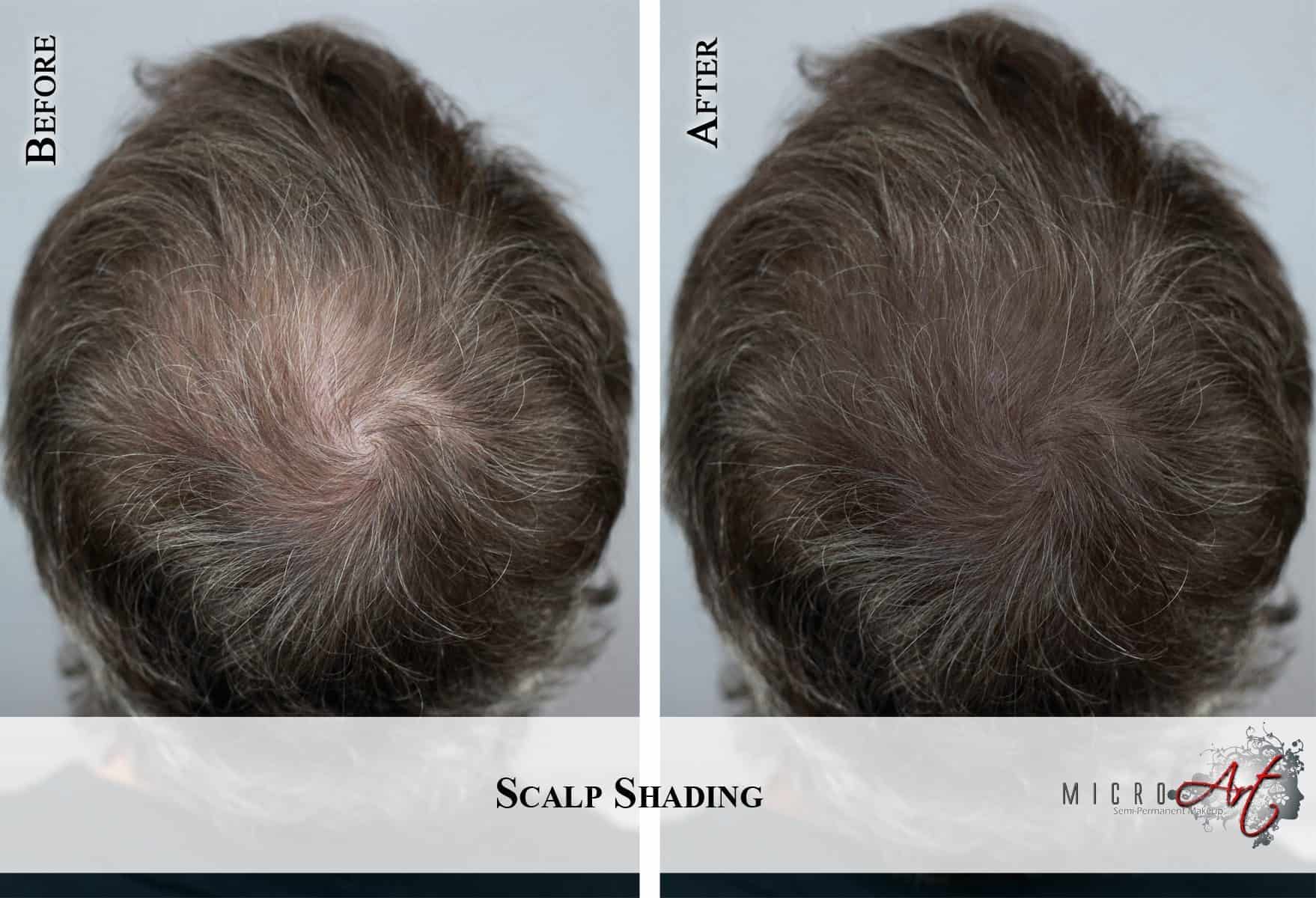 Scalp-4-Gary