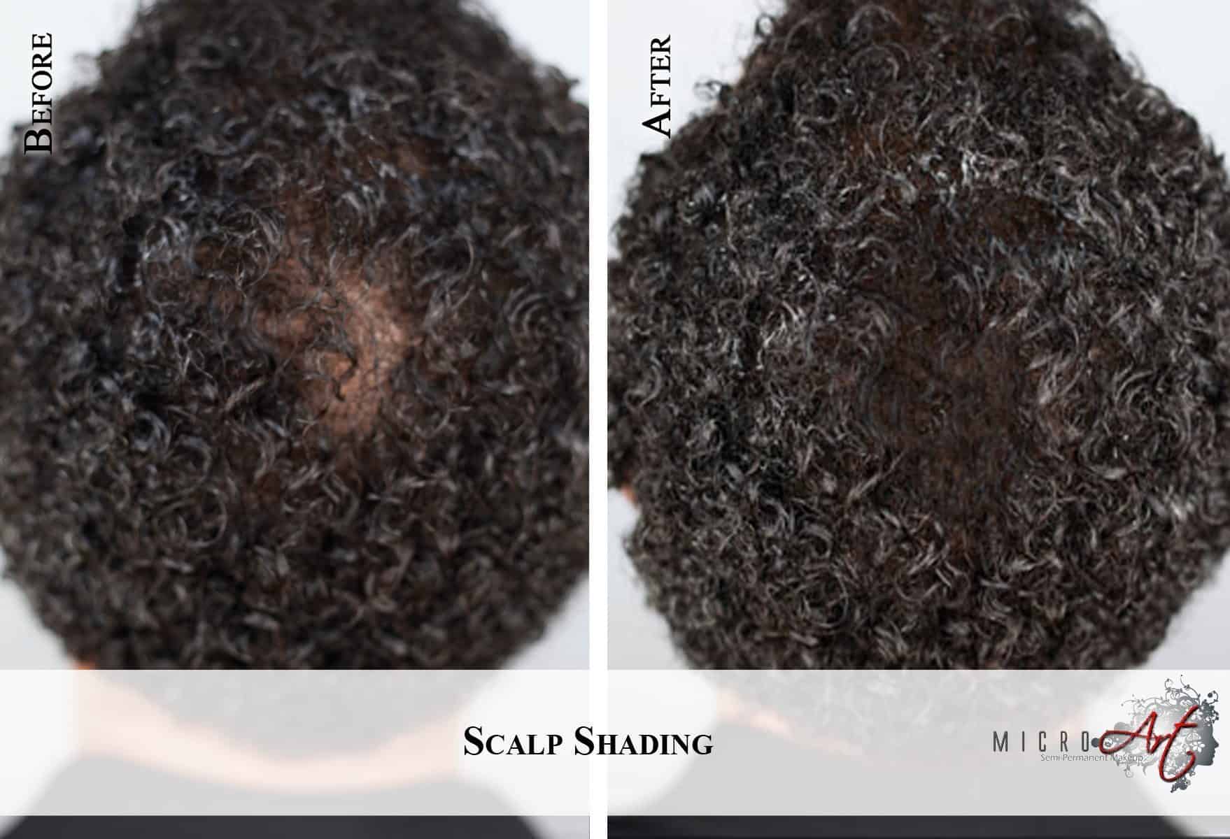 Scalp-7-Fro