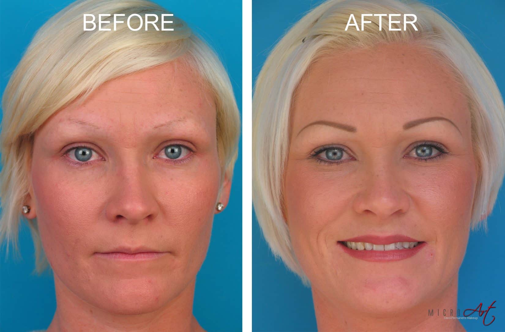 Before and After Photos of MicroArt Semi Permanent Makeup – an Alternative to Eyebrow Tattooing and Permanent Cosmetics -Amanda Before & After Photos of MicroArt Semi Permanent Makeup for Eyebrows, Eyeliner & Lips - an Alternative to Eyebrow Tattooing and Permanent Cosmetics