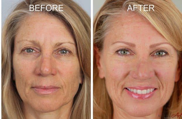 Companies and before after semi lips makeup permanent yorkdale plus size Permanent lips after and semi makeup before cheap plus size